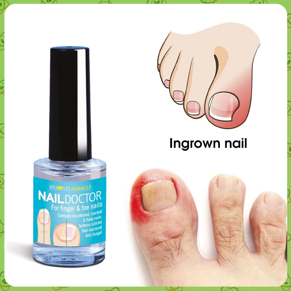 VYTALIVING BioClear Nail Doctor - Ingrown Toenail Treatment - Fungal Nail Treatment for Toenail – Aids in Toe Nail Care | 15 ml