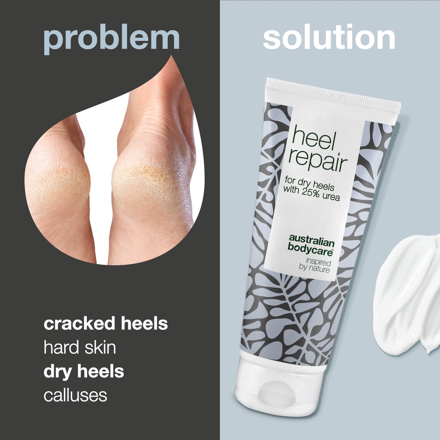 Australian Bodycare Cracked Heel Repair Cream 100ml | Tea Tree Oil Myrtle | Hard Skin Remover | 25% Urea Cream | Cracked Heel Balm | Heel Care for Dry & Cracked Feet | Australian Tea Tree Oil 100 ml (Pack of 1)